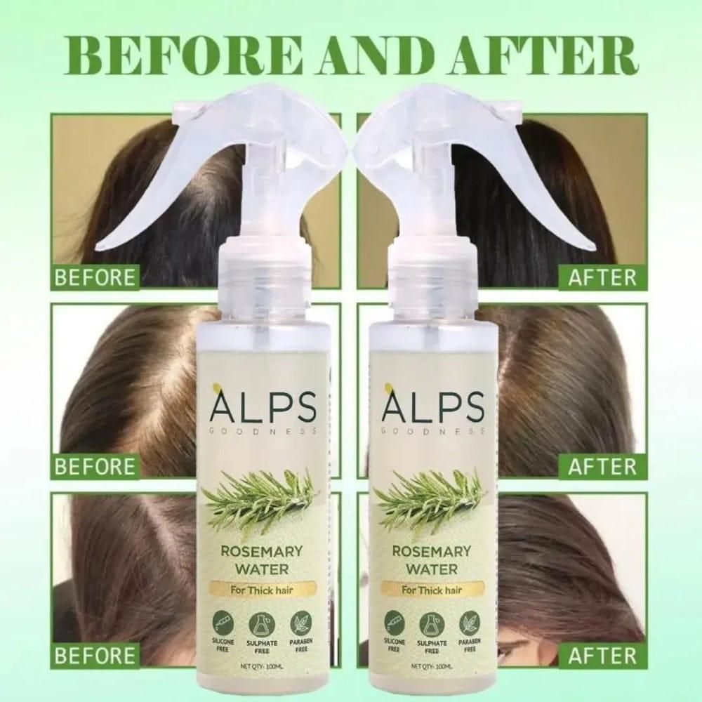 Alps Goodness 100% Pure Rosemary Water, Hair Spray For Regrowth, Buy 1 Get 2 Free