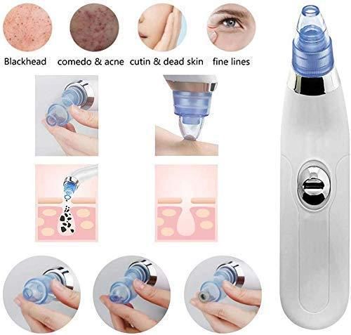 4 in 1 Multi-function Blackhead and Whitehead Remover Derma Suction (Vacuum Suction)